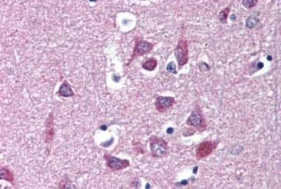 Immunohistochemistry-Paraffin: Kv1.3 Antibody [NBP3-14387] - Immunohistochemistry of formalin-fixed, paraffin-embedded human brain, cortex, after heat-induced antigen retrieval.